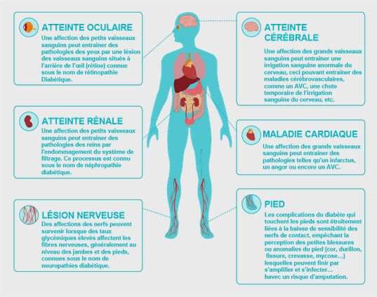 Les complications chroniques du diabète